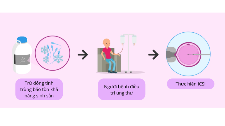 Trữ Tinh Trùng