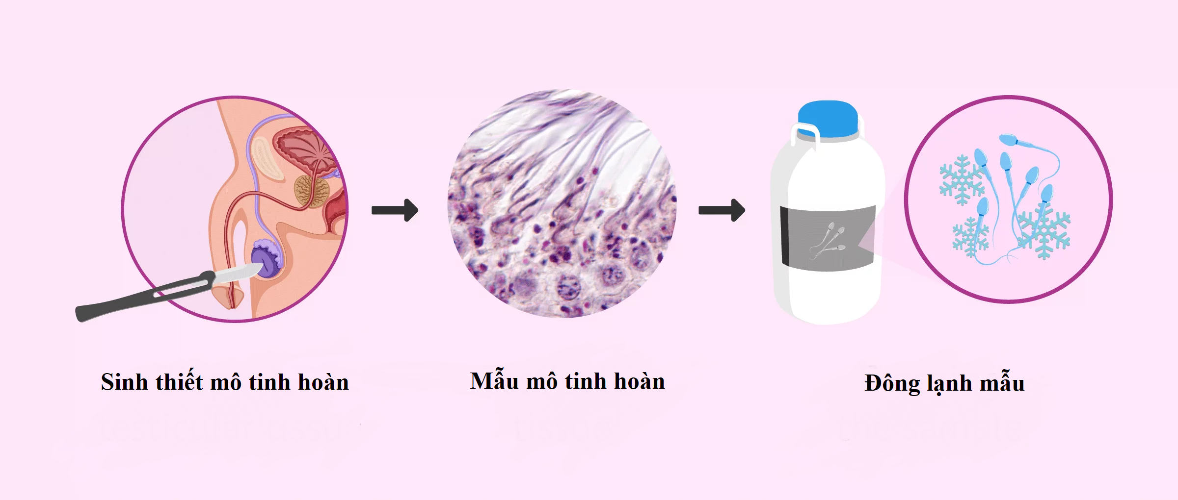 sinh thiết