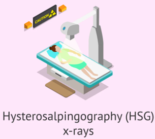 Cách thực hiện HSG
