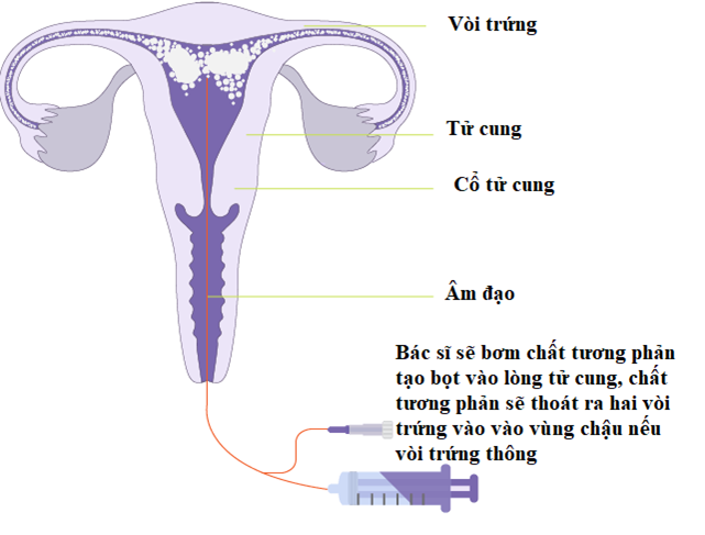 Cách thực hiện HyFoSy